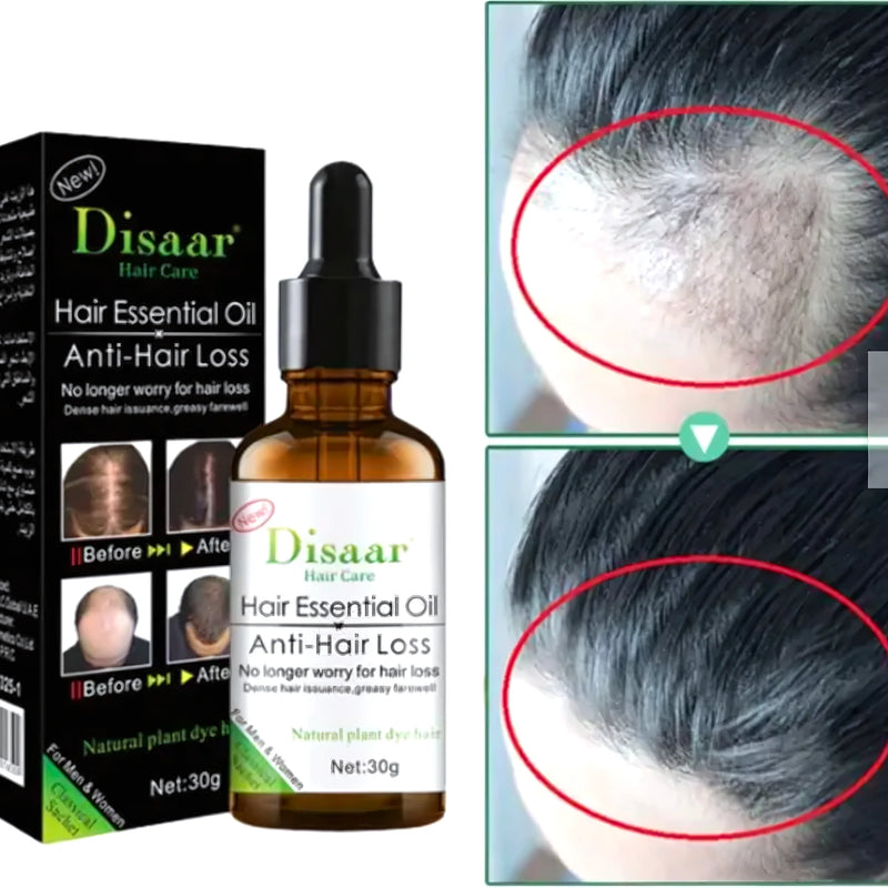 Aceite Anticaida Haircare Jengibre Serum - Varietas Chile - Santiago