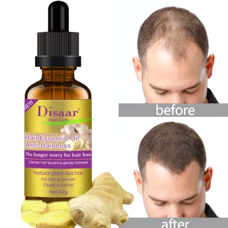 Aceite Anticaida Haircare Jengibre Serum - Varietas Chile - Santiago
