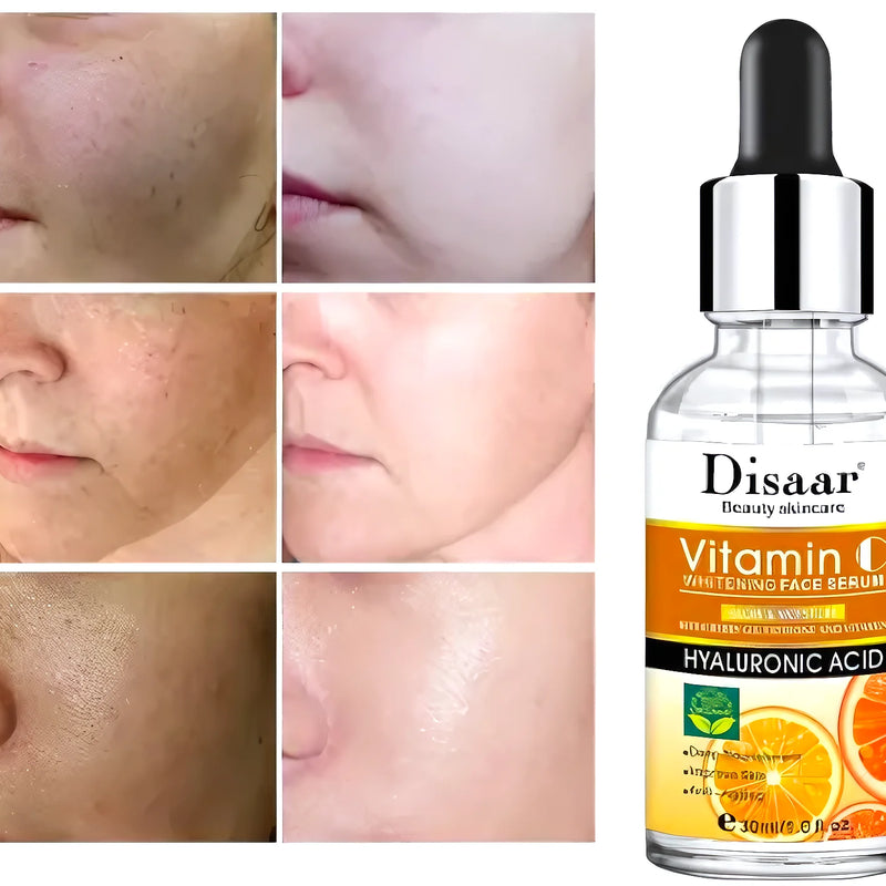 Serum Vitamina C Con Acido Hialuronico - Varietas Chile - Santiago