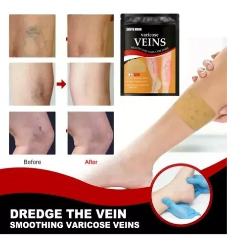 Parche Varices X2Pack