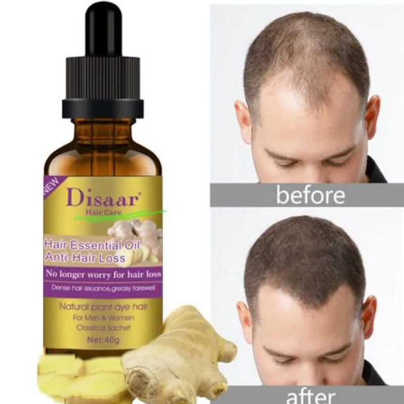 Aceite Anticaida Hair Jengibre Serum