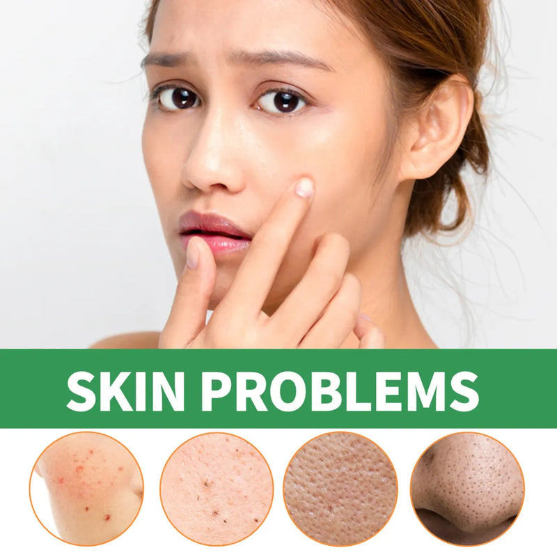 Parche Limpieza Profunda Elimina Puntos