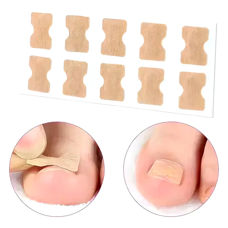 50 Parches Correctores Uñas Encarnadas - Varietas Chile - Santiago