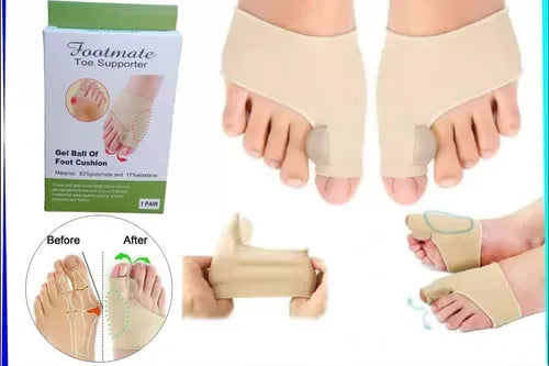 Par Corrector De Juanetes