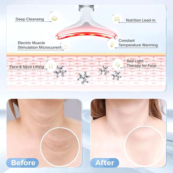 Masajeador Reductor De Papada Facial - Varietas Chile - Santiago