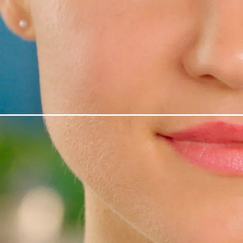 Depiladora Facial - Varietas Chile - Santiago