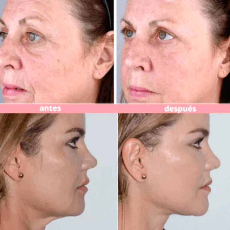 Masajeador Facial Microcorriente Usb - Varietas Chile - Santiago