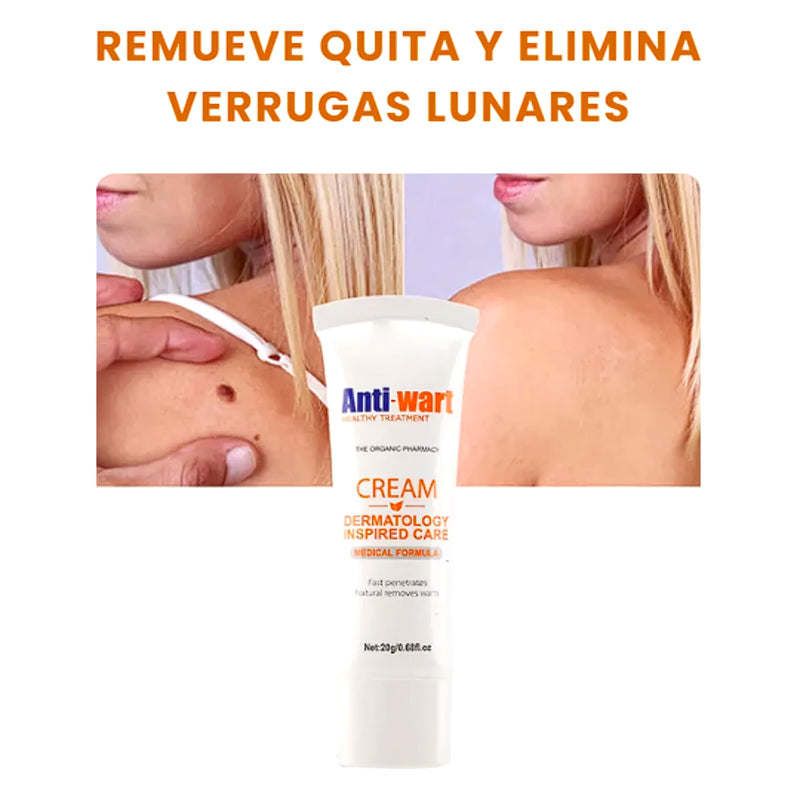 Crema Anti Verrugas Removedor - Varietas Chile - Santiago