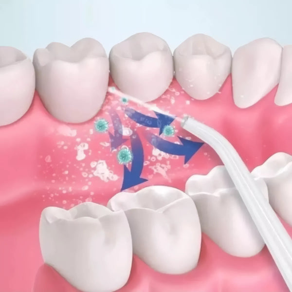 Irrigador Bucal De Dientes Portatil Usb