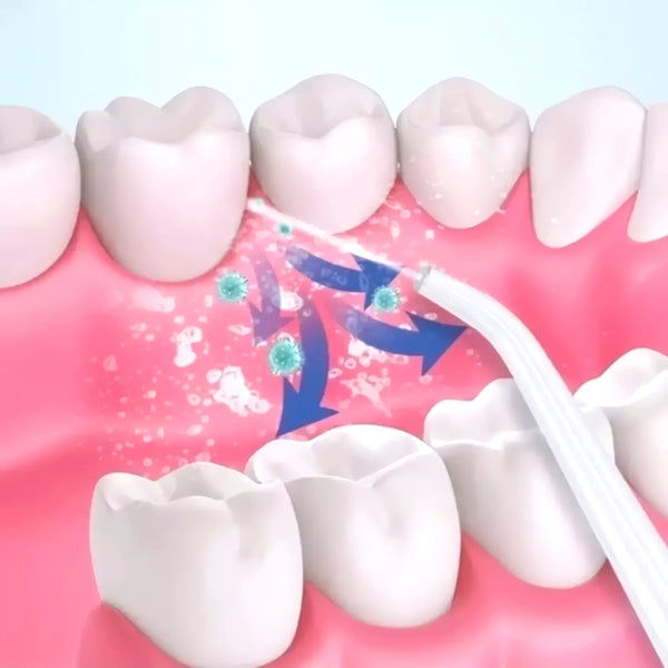Irrigador Bucal De Dientes Portatil Usb - Varietas Chile - Santiago