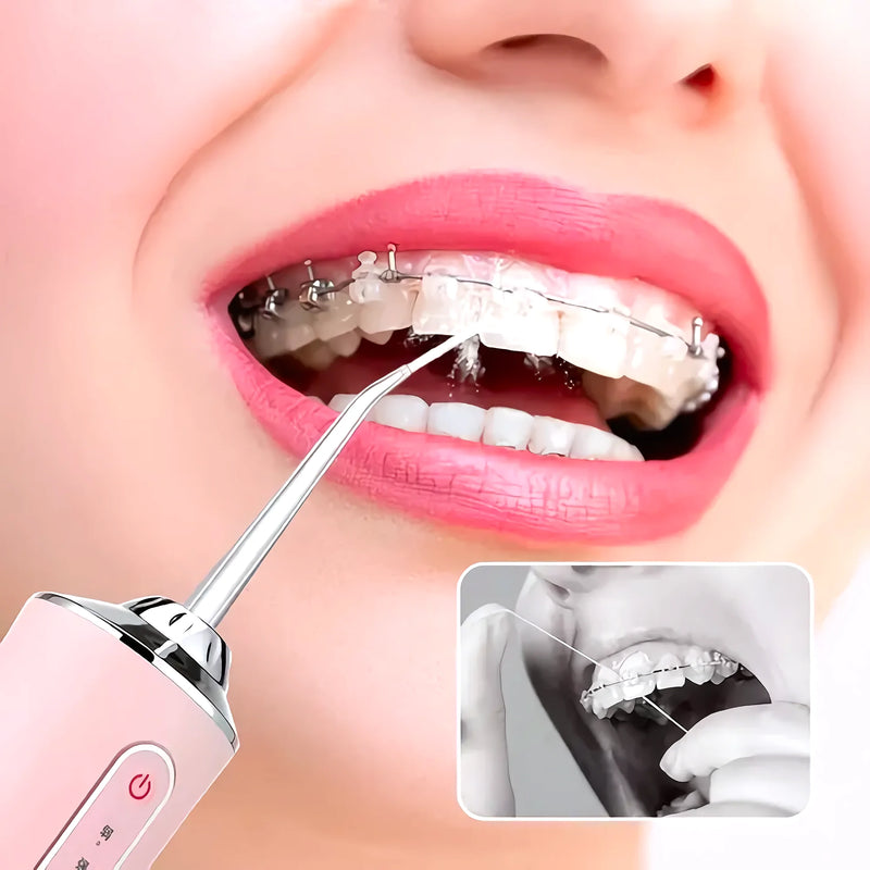 Irrigador Bucal De Dientes Portatil Usb - Varietas Chile - Santiago