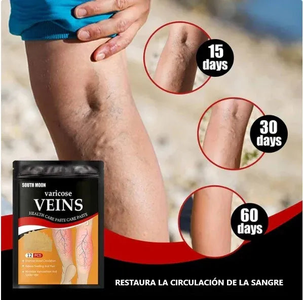 12 Parches De Varices
