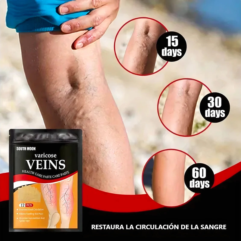 12 Parches De Varices - Varietas Chile - Santiago