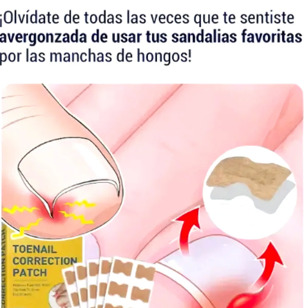 Parches Para Unas Encarnadas Del Pie - Varietas Chile - Santiago