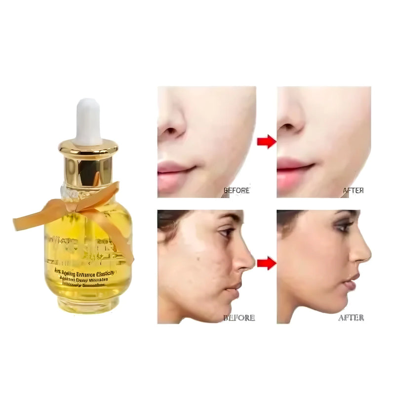 Serum Facial Pro Care Gold 40Ml 2X1 - Varietas Chile - Santiago