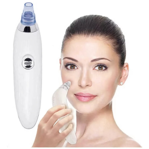 Extractor De Puntos Negros