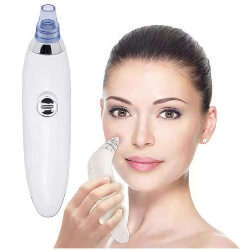 Extractor De Puntos Negros