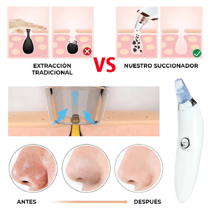 Extractor De Puntos Negros