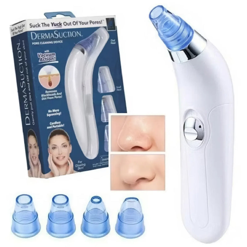 Extractor De Puntos Negros