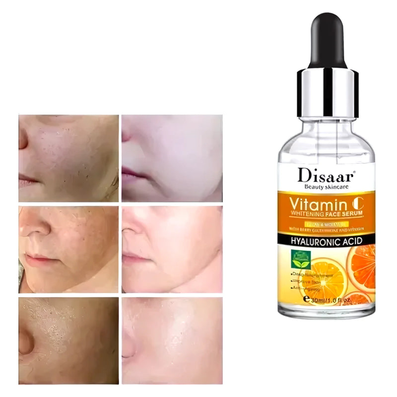 Serum Vitamina C Ácido Hialuronico - Varietas Chile - Santiago