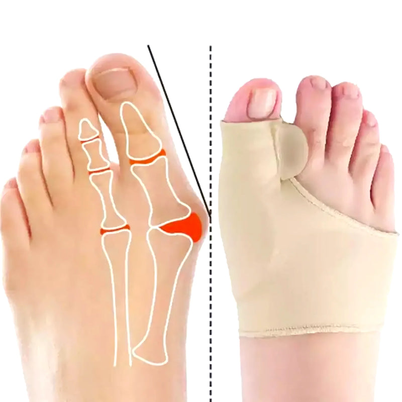 Pack De 2 Cajas De Corrector De Juanetes - Varietas Chile - Santiago