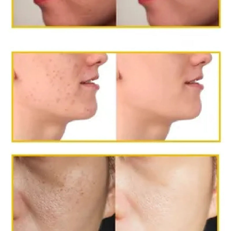 Jabón De Cúrcuma Piel Mas Suave 2X1