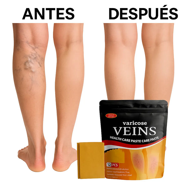 Parches Para Várices