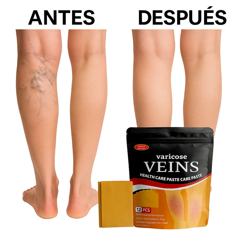 Parches Para Várices