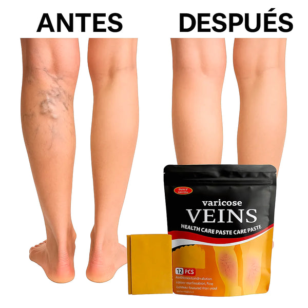 Parches Para Várices - Varietas Chile - Santiago