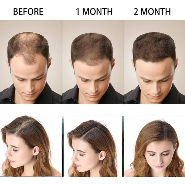 Pack Shampoo Y Serum Anticaida Disaar