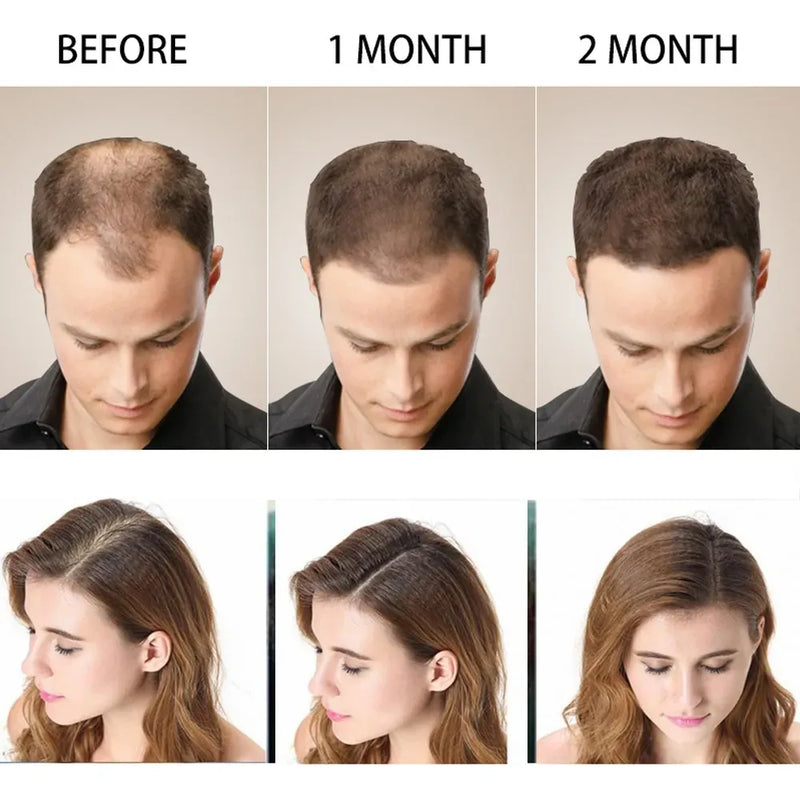 Pack Shampoo Y Serum Anticaida Disaar