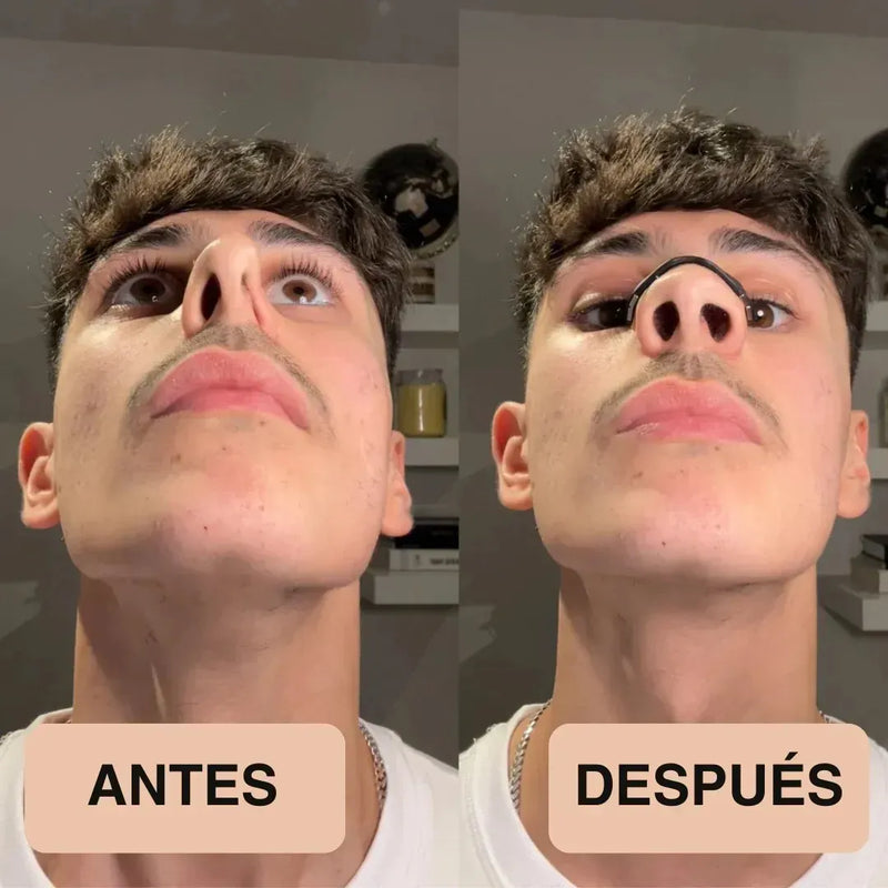 Tiras Nasales Antironquidos Magnéticas